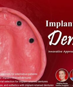 OHI-S Implant-Retained Dentures Innovative Approach to Full-Arch Prosthetics