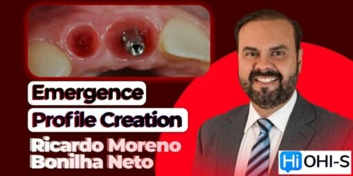 Emergence Profile Creation. Biologically Driven Implantology