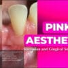 OHI-S Pink Aesthetics, Recession and Gingival Smile Treatment