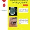 Pediatric Hematology Oncology Journal PDF