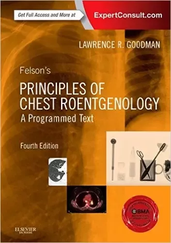 Discover the Best Free Radiology Books Available Online: 2024 Complete Guide Discover the Best Free Radiology Books Available Online: 2024 Complete Guide