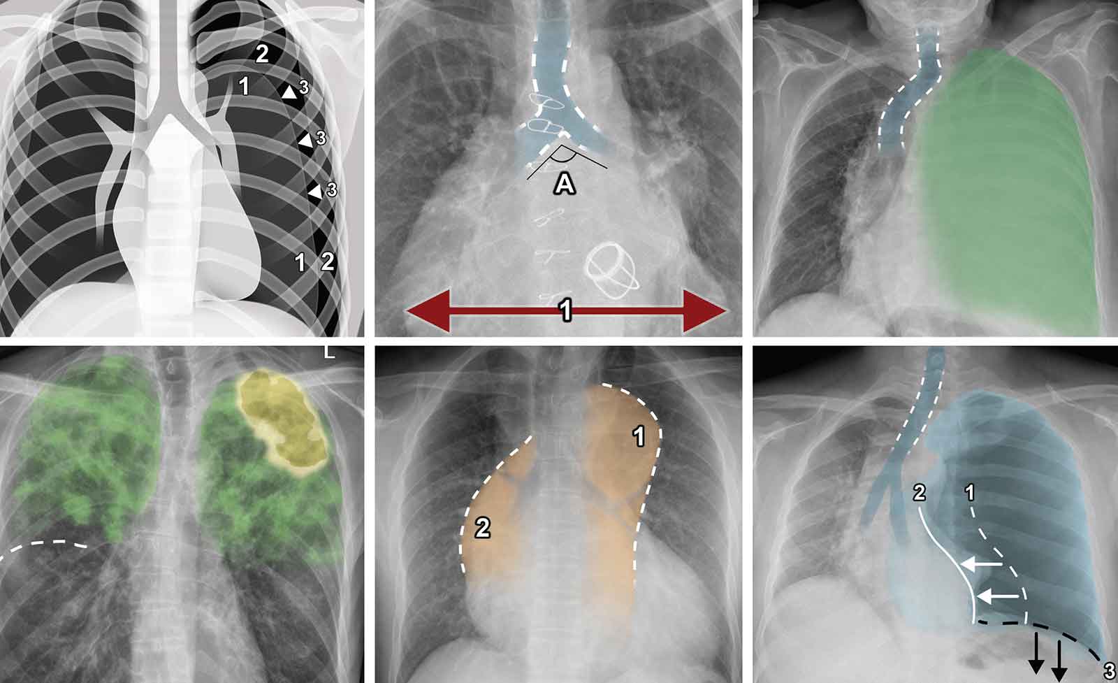 Discover the Best Free Radiology Books Available Online: 2024 Complete Guide Discover the Best Free Radiology Books Available Online: 2024 Complete Guide