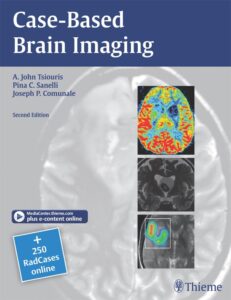 Discover the Best Free Radiology Books Available Online: 2024 Complete Guide Discover the Best Free Radiology Books Available Online: 2024 Complete Guide