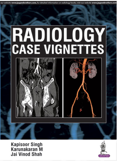 Discover the Best Free Radiology Books Available Online: 2024 Complete Guide Discover the Best Free Radiology Books Available Online: 2024 Complete Guide