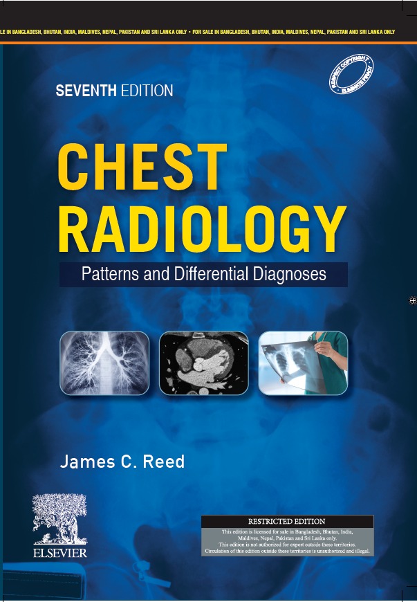 Discover the Best Free Radiology Books Available Online: 2024 Complete Guide Discover the Best Free Radiology Books Available Online: 2024 Complete Guide