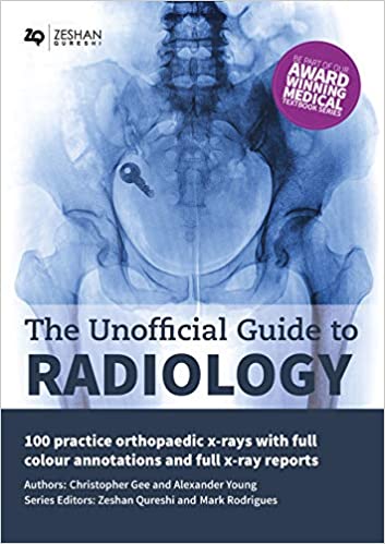 Discover the Best Free Radiology Books Available Online: 2024 Complete Guide Discover the Best Free Radiology Books Available Online: 2024 Complete Guide