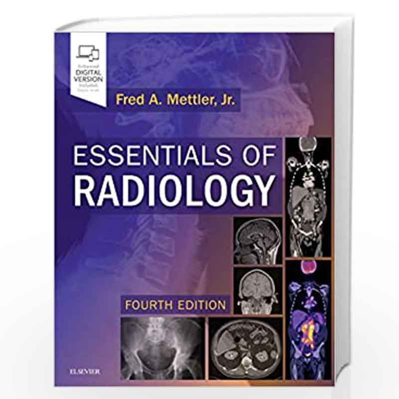 Discover the Best Free Radiology Books Available Online: 2024 Complete Guide Discover the Best Free Radiology Books Available Online: 2024 Complete Guide
