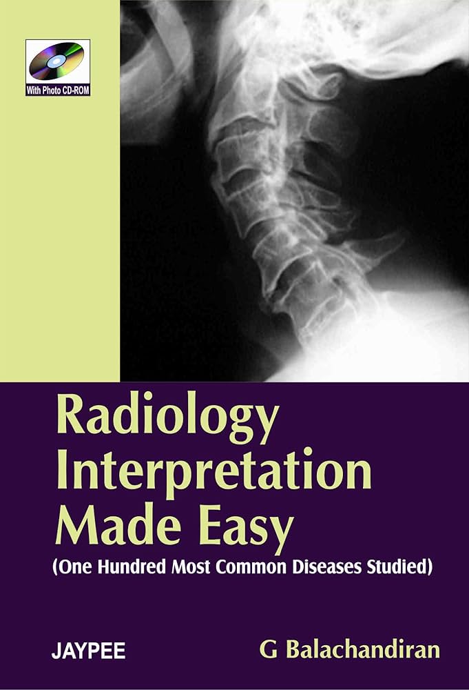 Discover the Best Free Radiology Books Available Online: 2024 Complete Guide Discover the Best Free Radiology Books Available Online: 2024 Complete Guide