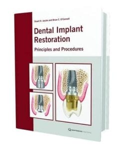 Dental Implant Restoration: Principles and Procedures (Scanned PDF)