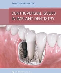 Controversial Issues in Implant Dentistry (Scanned PDF)