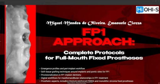 OHI-S FP1 Approach – Miguel Mendes de Oliveira, Emanuele Clozza Complete Protocols for Full-Mouth Fixed Prostheses