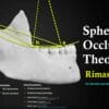 OHI-S Spherical Occlusion Theory – Rimas Šurna For Dentists and Dental Technician Team