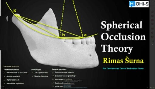 OHI-S Spherical Occlusion Theory – Rimas Šurna For Dentists and Dental Technician Team