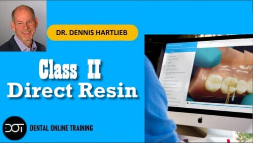 DOT Class II Direct Resin – Dennis Hartlieb