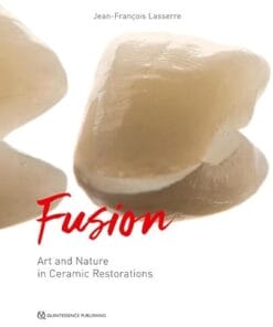 Fusion: Art and Nature in Ceramic Restorations; Fundamentals / Clinic and Laboratory