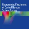 Neurosurgical Treatment of Central Nervous System Tumors: