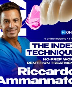 OHI-S – The Index Technique – No Prep Worn Dentition Treatment – Riccardo Ammannato