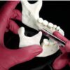 Exodontia Comprehensive Oral Surgery – Jason Hoium Module 14-18