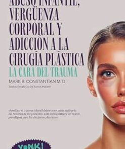 Abuso infantil, vergüenza corporal y adicción a la cirugía plástica: La cara del trauma (Yonki Books nº 20) (Spanish Edition) (EPUB)