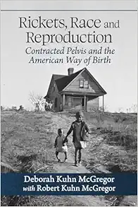 Rickets, Race and Reproduction: Contracted Pelvis and the American Way of Birth (EPUB)