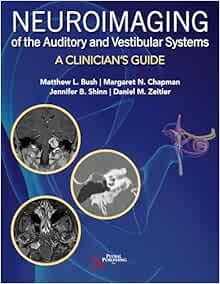 Neuroimaging of the Auditory and Vestibular Systems: A Clinician’s Guide (PDF)