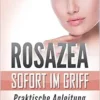 Rosazea sofort im Griff: Praktische Anleitung (German Edition) (EPUB)