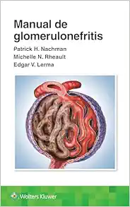 Manual de glomerulonefritis (Spanish Edition) (EPUB)