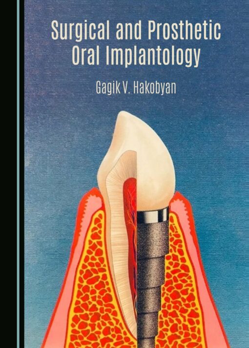 Surgical and Prosthetic Oral Implantology (PDF)