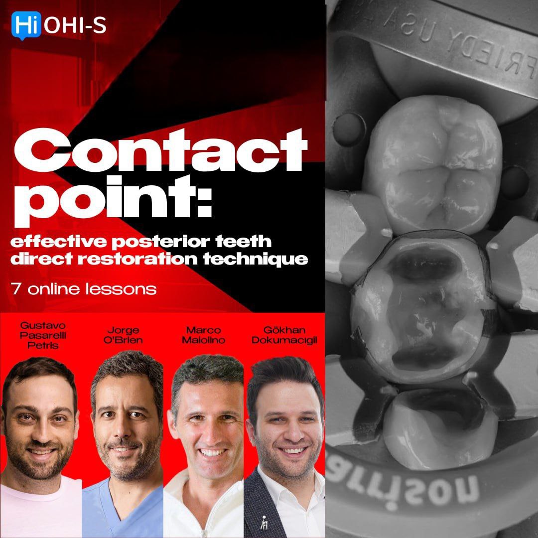 Contact point: effective posterior teeth direct restoration technique