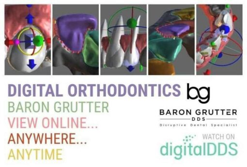 Digital Orthodontics Online Course (Clear Aligners) – Baron Grutter