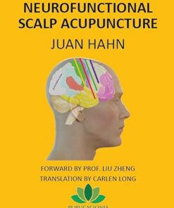 Neurofunctional scalp acupuncture