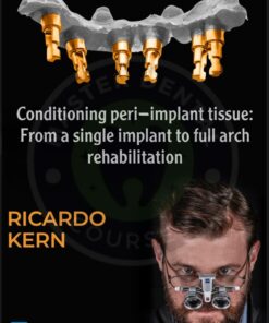 OHI-S Conditioning peri-implant tissue: From a single implant to full arch rehabilitation