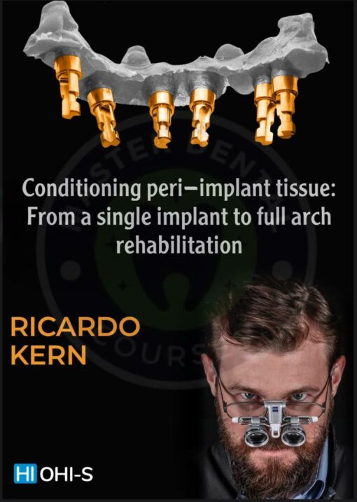 OHI-S Conditioning peri-implant tissue: From a single implant to full arch rehabilitation