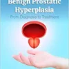 Benign Prostatic Hyperplasia: From Diagnosis to Treatment (PDF)