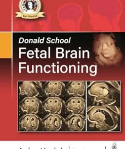 Donald School Fetal Brain Functioning (EPUB)