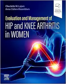Evaluation and Management of Hip and Knee Arthritis in Women (EPUB)
