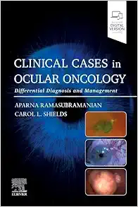 Clinical Cases in Ocular Oncology: Differential Diagnosis and Management (PDF)