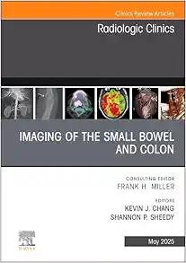Imaging of the Small Bowel and Colon, An Issue of Radiologic Clinics of North America (Volume 63-3) (The Clinics: Radiology, Volume 63-3) (EPUB)