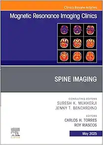 Spine Imaging, An Issue of Magnetic Resonance Imaging Clinics of North America (Volume 33-2) (The Clinics: Radiology, Volume 33-2) (EPUB)