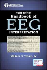 Handbook of EEG Interpretation, 3rd Edition (EPUB)