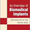 An Overview of Biomedical Implants: Biomaterials for the Human Body (EPUB)