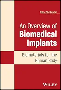 An Overview of Biomedical Implants: Biomaterials for the Human Body (EPUB)