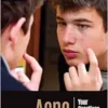 Acne: Your Questions Answered (Q&A Health Guides) (EPUB)