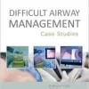 Difficult Airway Management: Case Studies (EPUB)