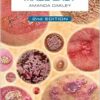Dermatology Made Easy, 2nd edition (PDF)