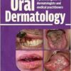 Oral Dermatology (EPUB)