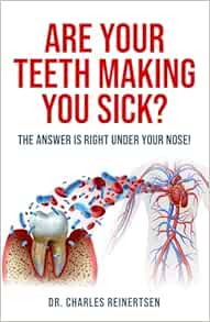 Are Your Teeth Making You Sick? (EPUB)