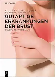 Gutartige Erkrankungen der Brust: Ein Leitfaden für die Praxis (German Edition) (PDF)