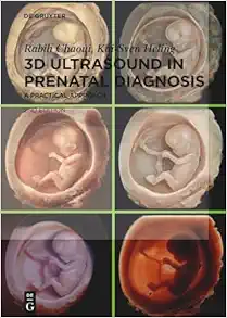 3D Ultrasound in Prenatal Diagnosis: A Practical Approach (EPUB)
