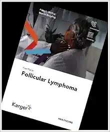 Fast Facts: Follicular Lymphoma (PDF)